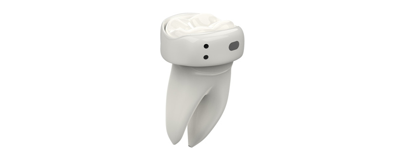 Bluetooth LE wireless monitor enables continuous oral health management